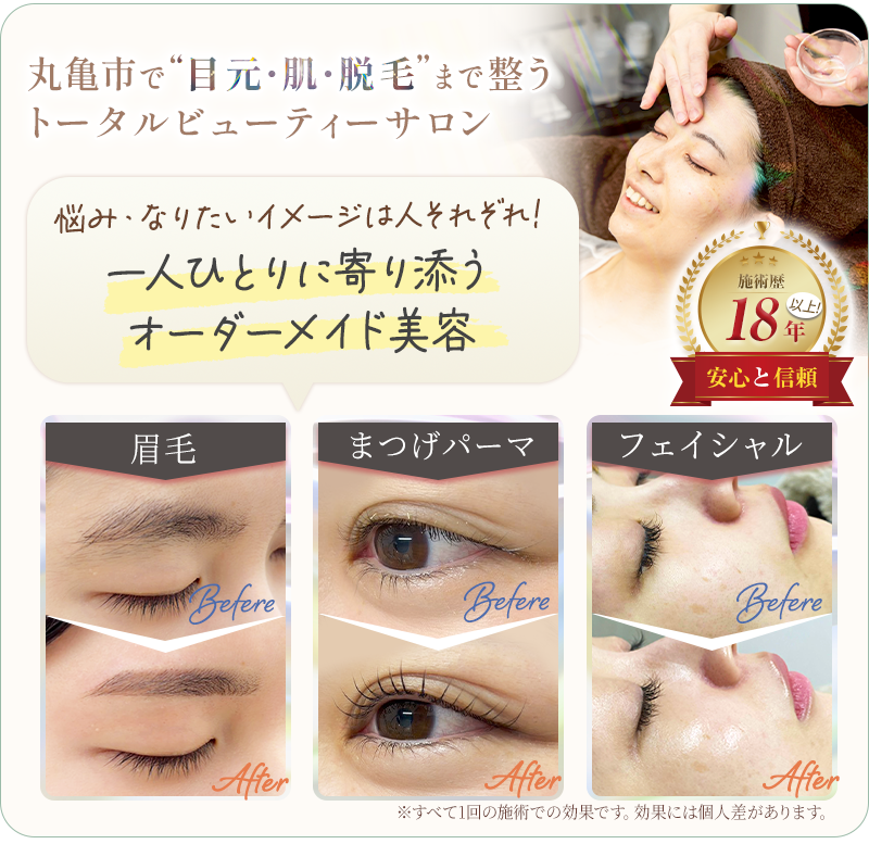 ビフォーアフター画像